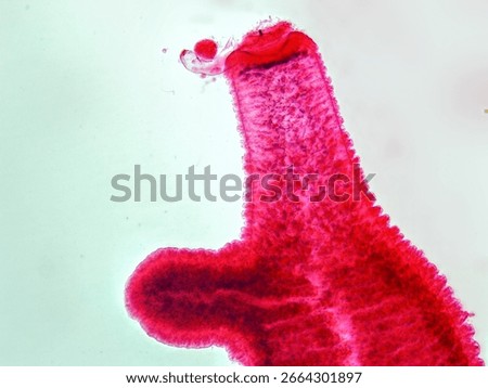 Histology Microscope Image of Hydra with Budding (100x)