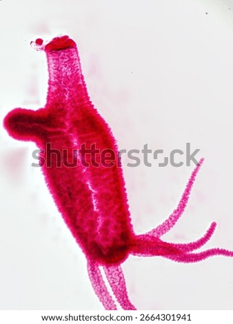 Histology Microscope Image of Hydra with Budding (40x)