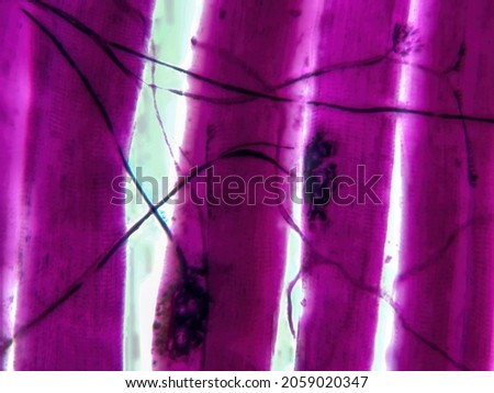 Histology microscope image of motor unit synapse of muscle fibers (400x)