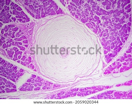 Histology microscope image of Pacinian corpuscle of the dermis in skin (100x)