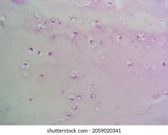 Histology Microscope Image Of White Fibrocartilage (400x)