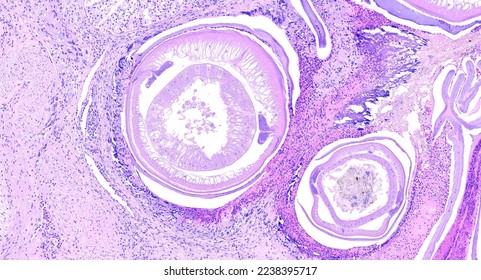 Histology of nematode worms (Heterakis
isolonche) in pheasant intestine, 100x magnification. - Shutterstock ID 2238395717
