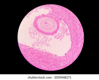 Histology Of Ovarian Follicles (Graafian Follicle) : Educational Microscopic (LM) Image