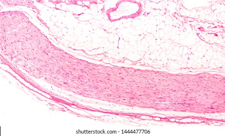 Histology Of A Peripheral Nerve In Longitudinal Section, Composed Of Bundles Of Fibers, With Axons Tightly Wrapped With Myelin.   