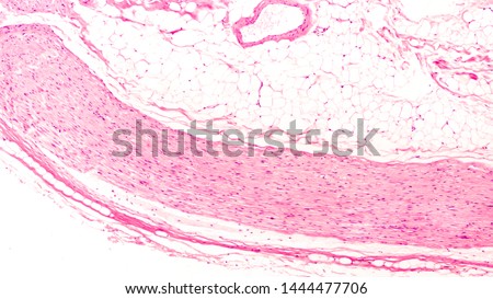 Histology of a peripheral nerve in longitudinal section, composed of bundles of fibers, with axons tightly wrapped with myelin.   
