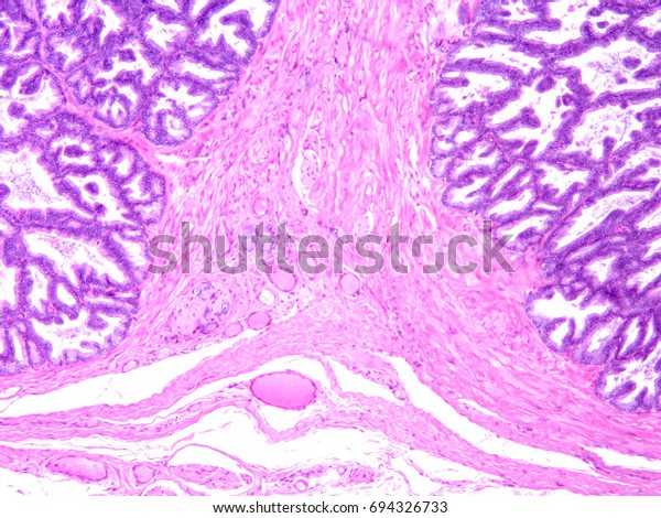 Histology Prostate Urethra Dog Tissue Show Stock Photo 694326733 ...