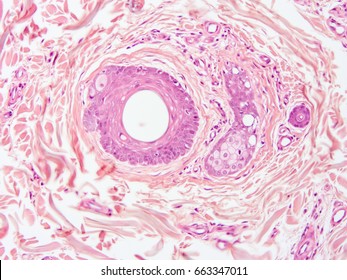 Histology Scalp Hair Follicle Human Tissue Stock Photo (Edit Now) 664054435