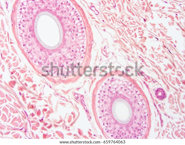 Histology Scalp Hair Follicle Human Tissue Stock Photo 659764063 ...