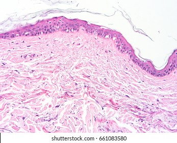 Histology of skin human tissue , show epithelium tissue and connective tissue with microscope view