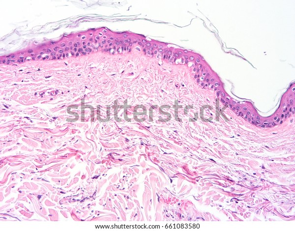 Histology Skin Human Tissue Show Epithelium Stock Photo (Edit Now ...