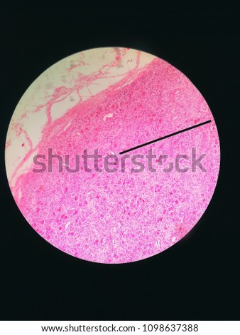 Histology slide sample