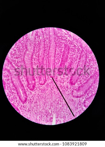 histology slide samples