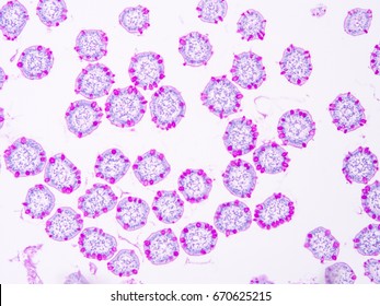 Histology Of Small Intestine Human Tissue , Show Epithelium Tissue, Connective Tissue And Goblet Cell With Microscope View