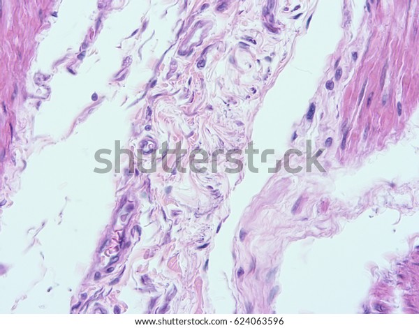 Histology Smooth Muscle Uterine Wall Show Stock Photo 624063596 ...