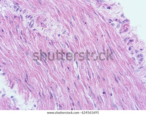 Histology of smooth muscle of uterine\
wall , show smooth muscle tissue with microscope\
view
