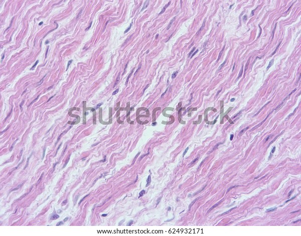 Histology of smooth muscle of uterine
wall , show smooth muscle tissue with microscope
view