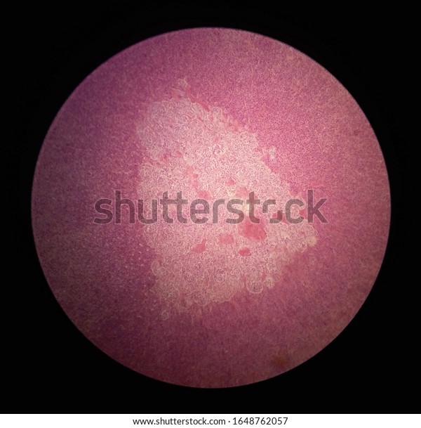Histology specimen of adrenal\
gland of rat under light microscope with hematoxylin eosin stain\
