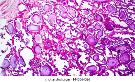 203 Prostate gland histology Images, Stock Photos & Vectors | Shutterstock