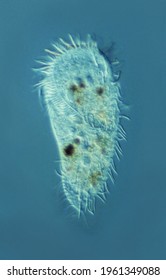 Histriculus, Portrait Of Single Living Ciliate (Protista) Cell