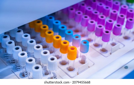 Hitech Biochemistry Laboratory Equipment Details Closeup With Test Tube For Biological Experiments In Laboratory