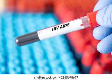 Hiv Aids. Hiv Aids Disease Blood Test In Doctor Hand