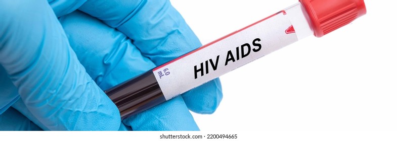 Hiv Aids. Hiv Aids Disease Blood Test In Doctor Hand