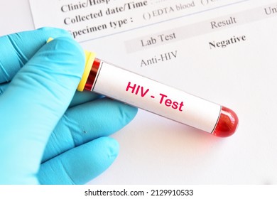 Hiv Negative Test Result Blood Sample Stock Photo 2129910533 | Shutterstock