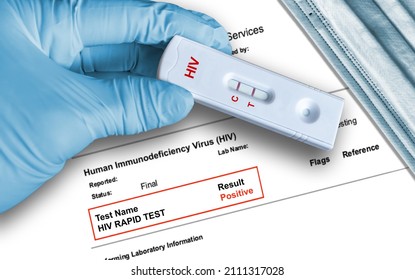 HIV positive antigen test result by using rapid self testing device held by hand in medical glove with medical face mask in background.  - Shutterstock ID 2111317028