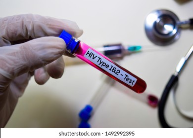 HIV Type 1 & 2 - Test with blood sample. Top view isolated on office desk. Healthcare/Medical concept - Shutterstock ID 1492992395