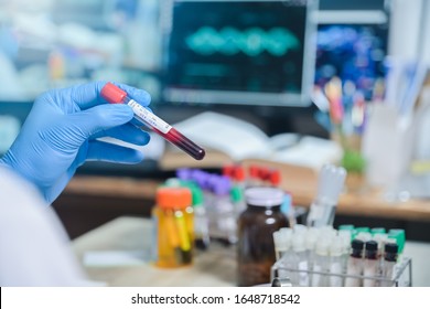 HIV VDRL Label Blood Test Tube In Medical Scientist Hand In Laboratory Room At Hospital, Blood Test Tube For Analysis For Diagnosis Illness Results