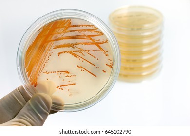 Holding Plate With Bacterial Colonies Of Streptococcus Agalactiae / Colonies Of Bacteria Streptococcus Agalactiae In Culture Medium Plate