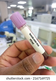 Holds a blood sample tube with blood for Varicella-Zoster Virus PCR test.