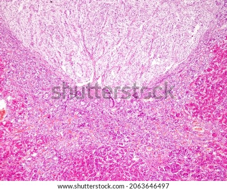 Horizontal (coronal) section of a human pituitary showing the intermediate lobe, with small cysts and strands of basophilic cells. Above is the posterior lobe, which resembles nerve tissue