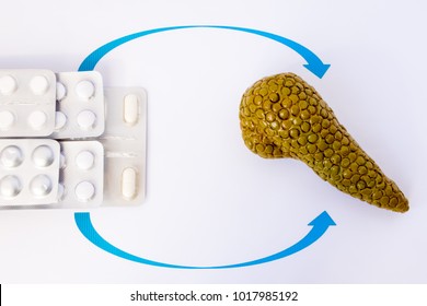 Hormone Or Enzyme Replacement Therapy Of Pancreas (indigestion) Concept Photo. Model Of Pancreas Gland Is Close To Drugs In Blisters On Which Arrows Are Drawn To Organ, Symbolizing Enzyme Replacement