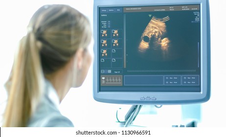 In The Hospital, Obstetrician Uses Transducer For Ultrasound/ Sonogram Screening / Scanning Belly Of The Pregnant Woman. Computer Screen Shows 3D Image Of The Healthy Forming Baby.