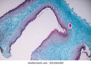 Host cells with spores (mold) are inside wood under the microscope for education.

