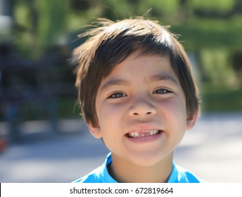 Hot Summer Day A Happy Young Boy With Smile On His Face Missing Some Front Tooth.