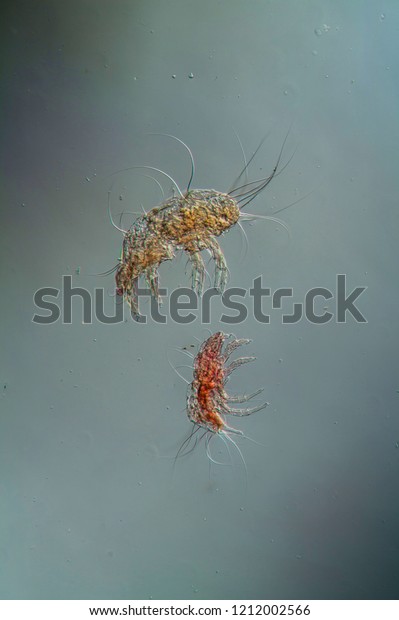 House Dust Mites Under Microscope 100x Stock Photo Edit Now