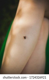 House Fly Sits On A Female Foot. House Fly, Food Contamination Hygiene Concept. The Flies Are Insect Carriers Of Cholera.