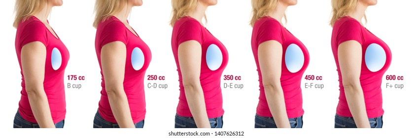 How to choose breast implants. Different types and sizes of breast implants for different results.