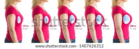 How to choose breast implants. Different types and sizes of breast implants for different results.