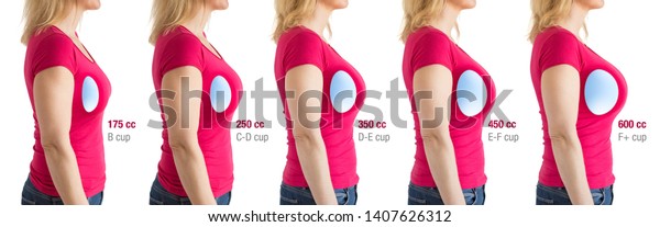 Bust Size 7 598 Shutterstock   How Choose Breast Implants Different 600w 1407626312 