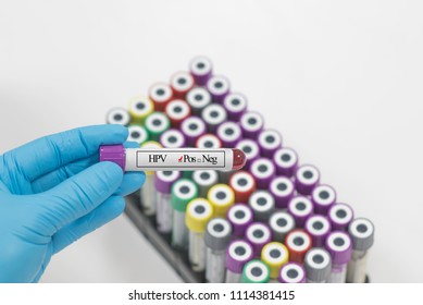 HPV Virus Testing