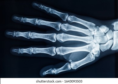 Human Adult Female Right Hand Bones Stock Photo 1643093503 | Shutterstock