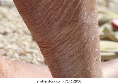 Human Aging, Sagging And Aged Skin Of The Human Body
