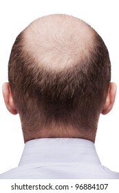 Human alopecia or hair loss - adult man bald head rear or back view