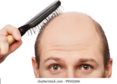 Human Alopecia Or Hair Loss - Adult Man Hand Holding Comb On Bald Head