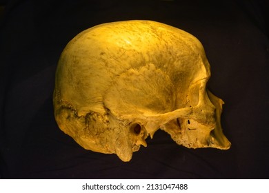 Human anatomy. A human skull without a jaw.Lateral View