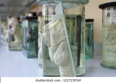 Human Anatomy. Wet specimens part of the human body in formalin. Medical science technology. Human organ