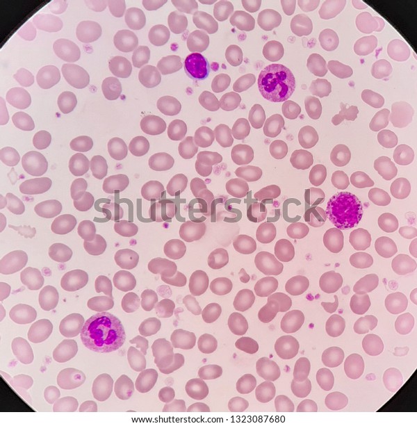 Human Blood Smear Hypochromic Red Blood Stock Photo (Edit Now) 1323087680